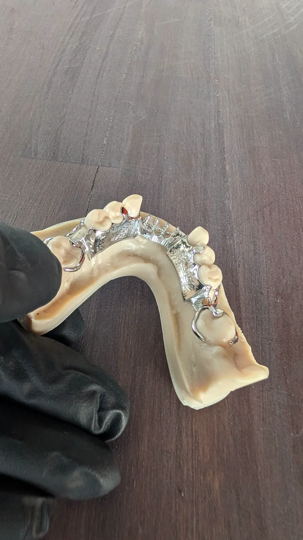 Lower cobalt-chrome framework shown from the occlusal view