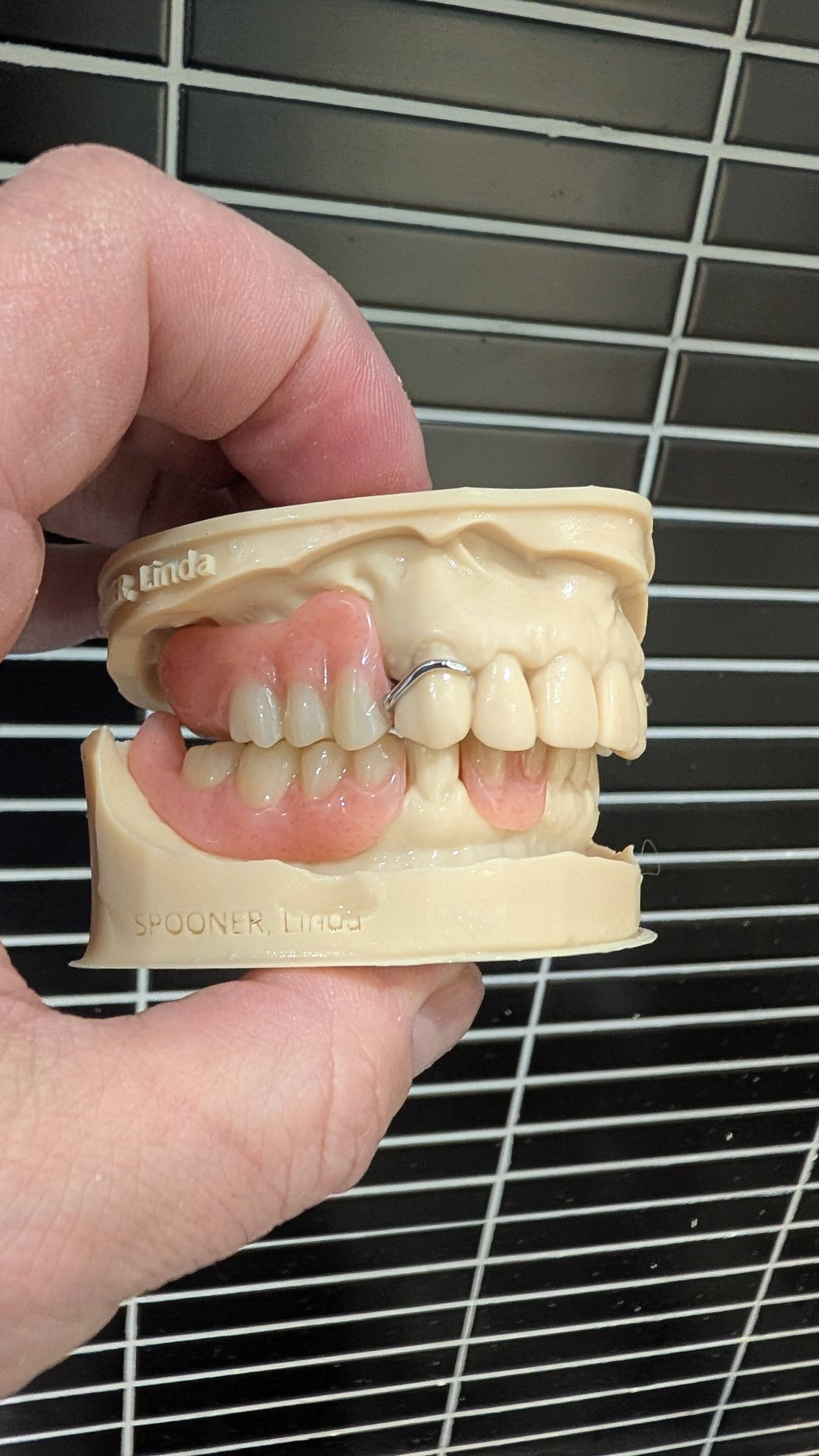 Articulated denture models - front view