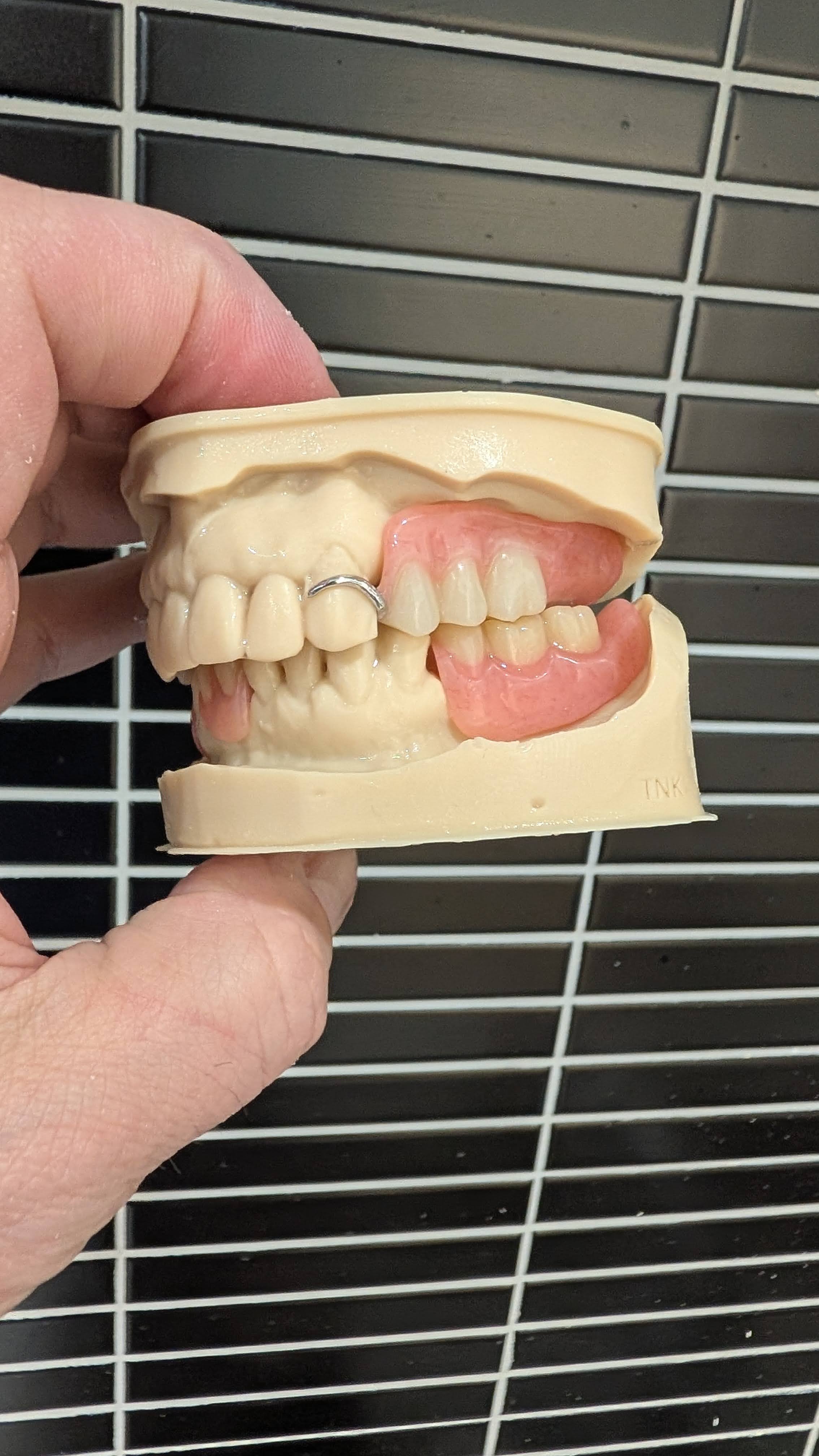 Articulated denture models - side view