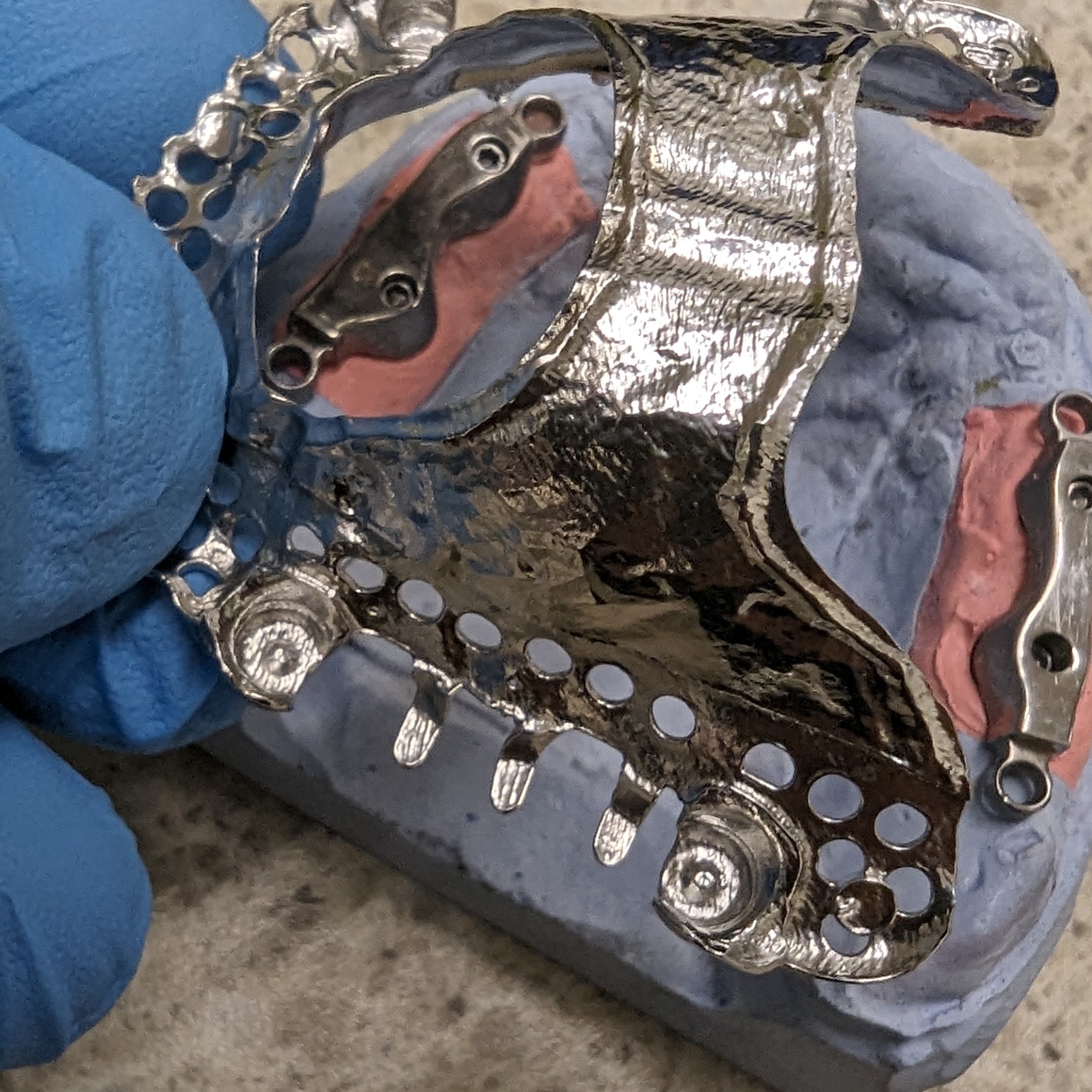 Polished partial denture framework on dental model