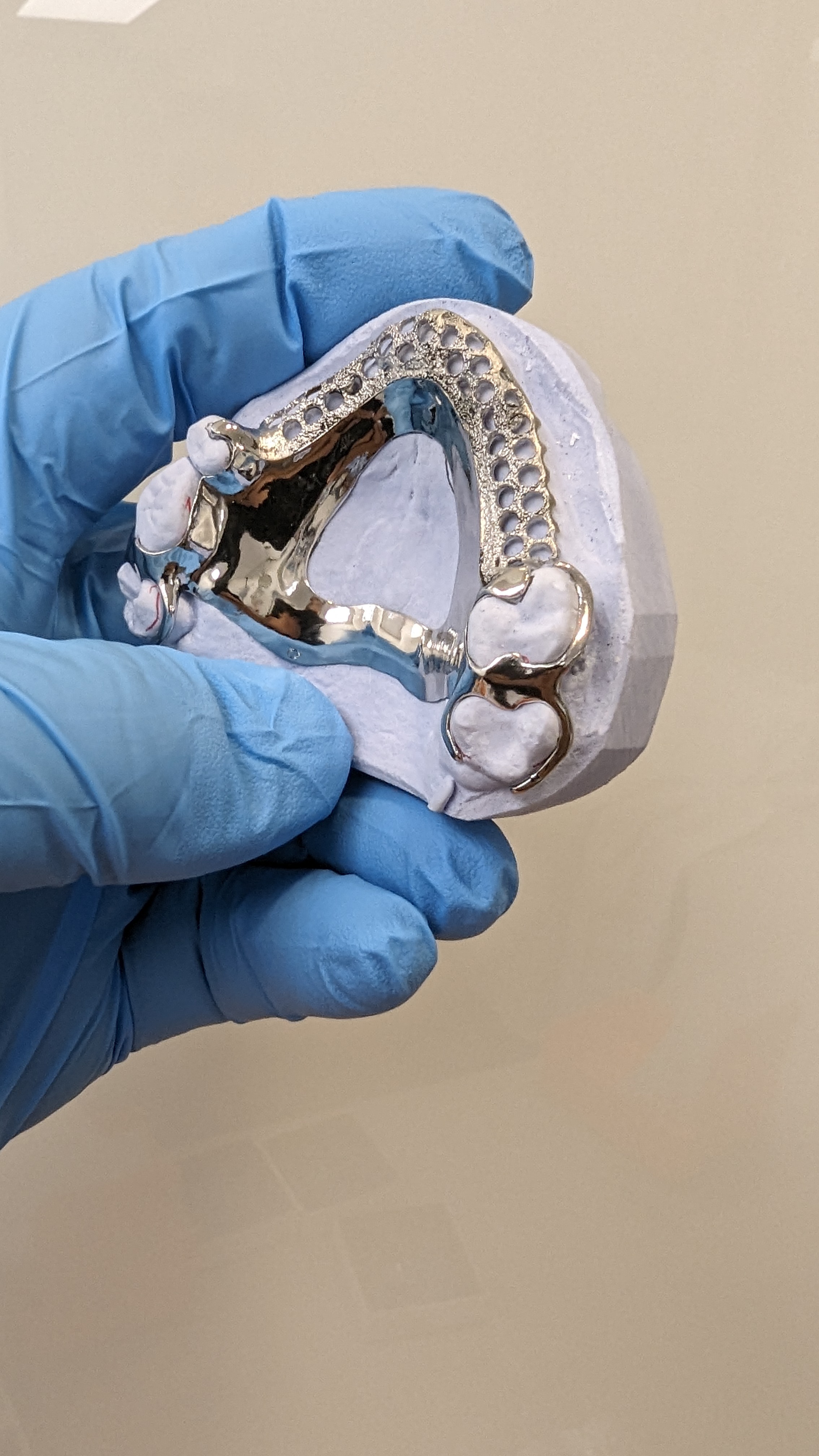 Polished upper partial with clasps