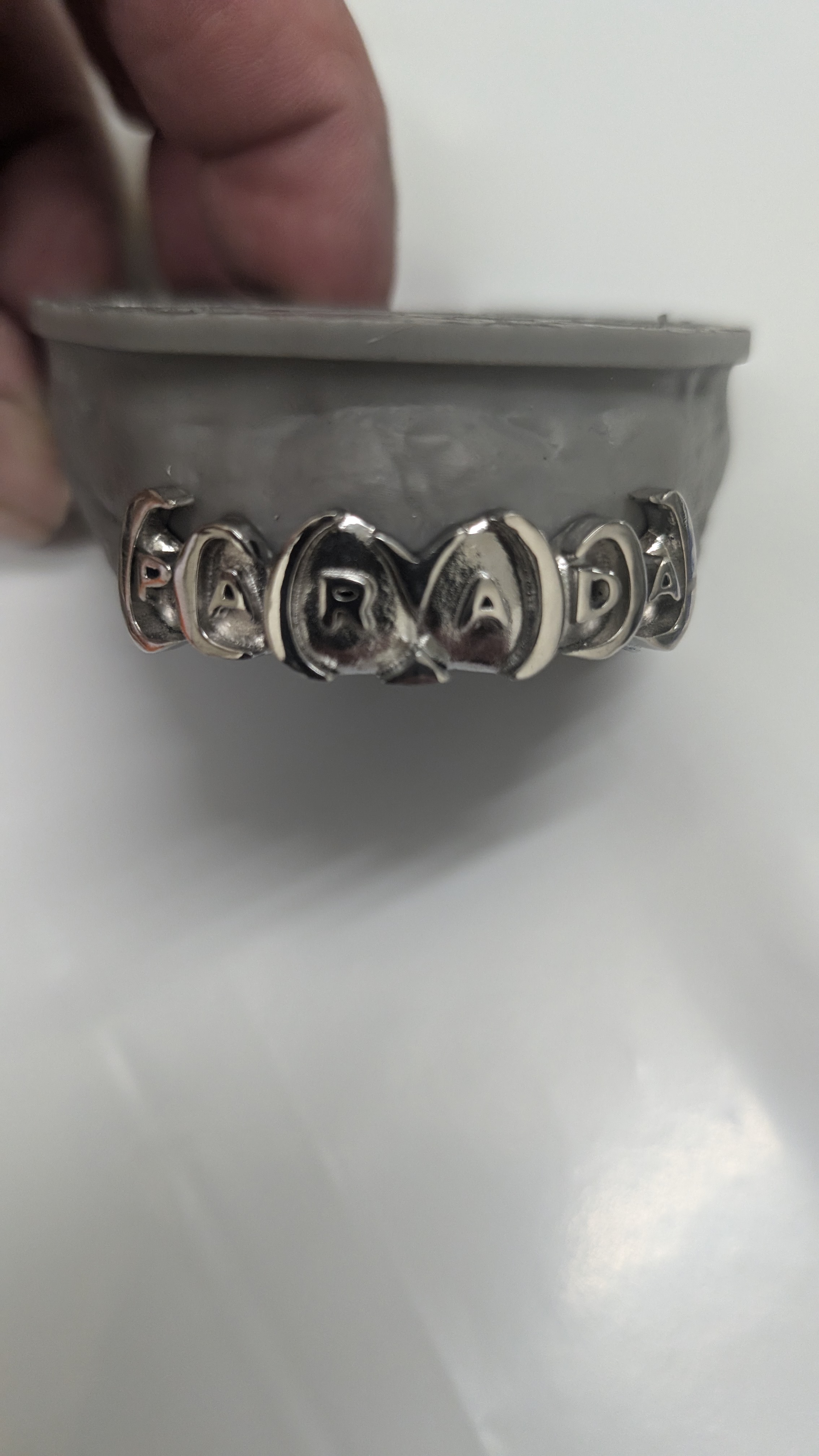 Custom PARADA grillz close-up on dental model
