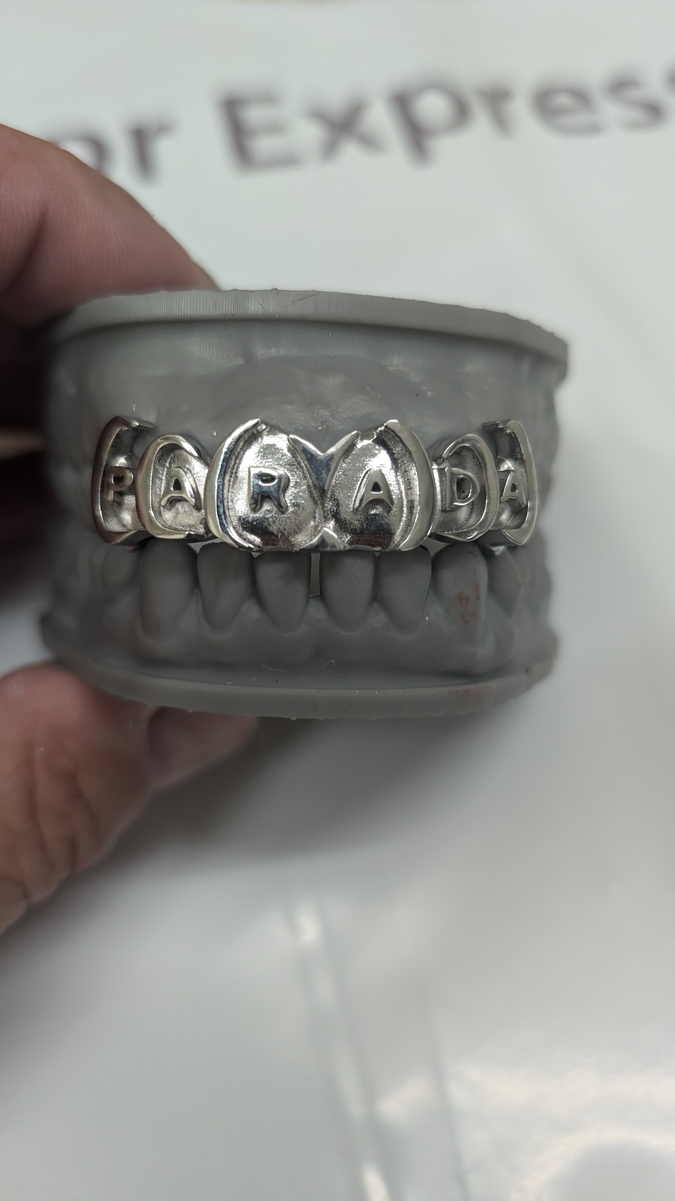 Custom PARADA grillz full view on dental model