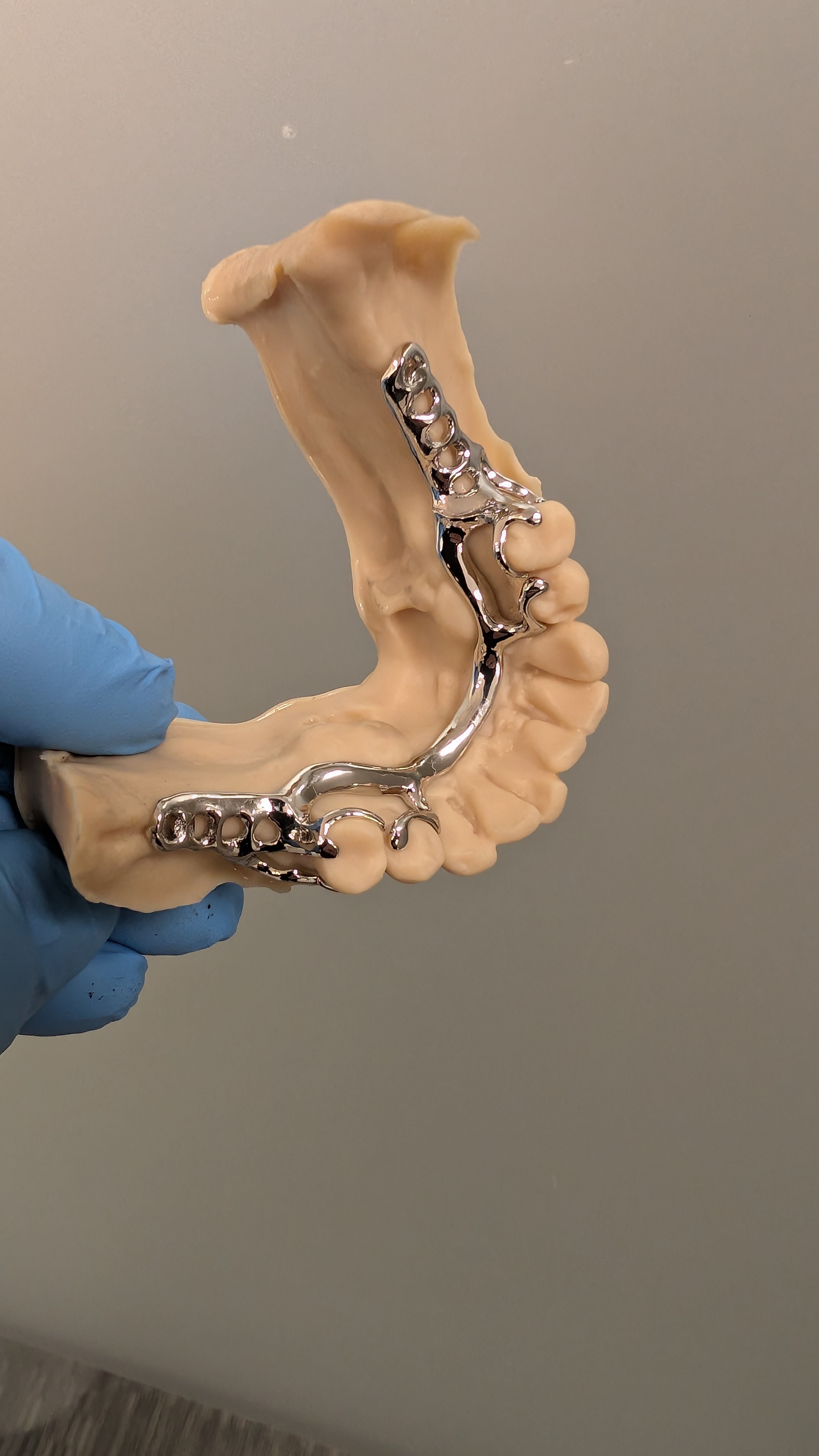 Lower partial framework on dental model - side view