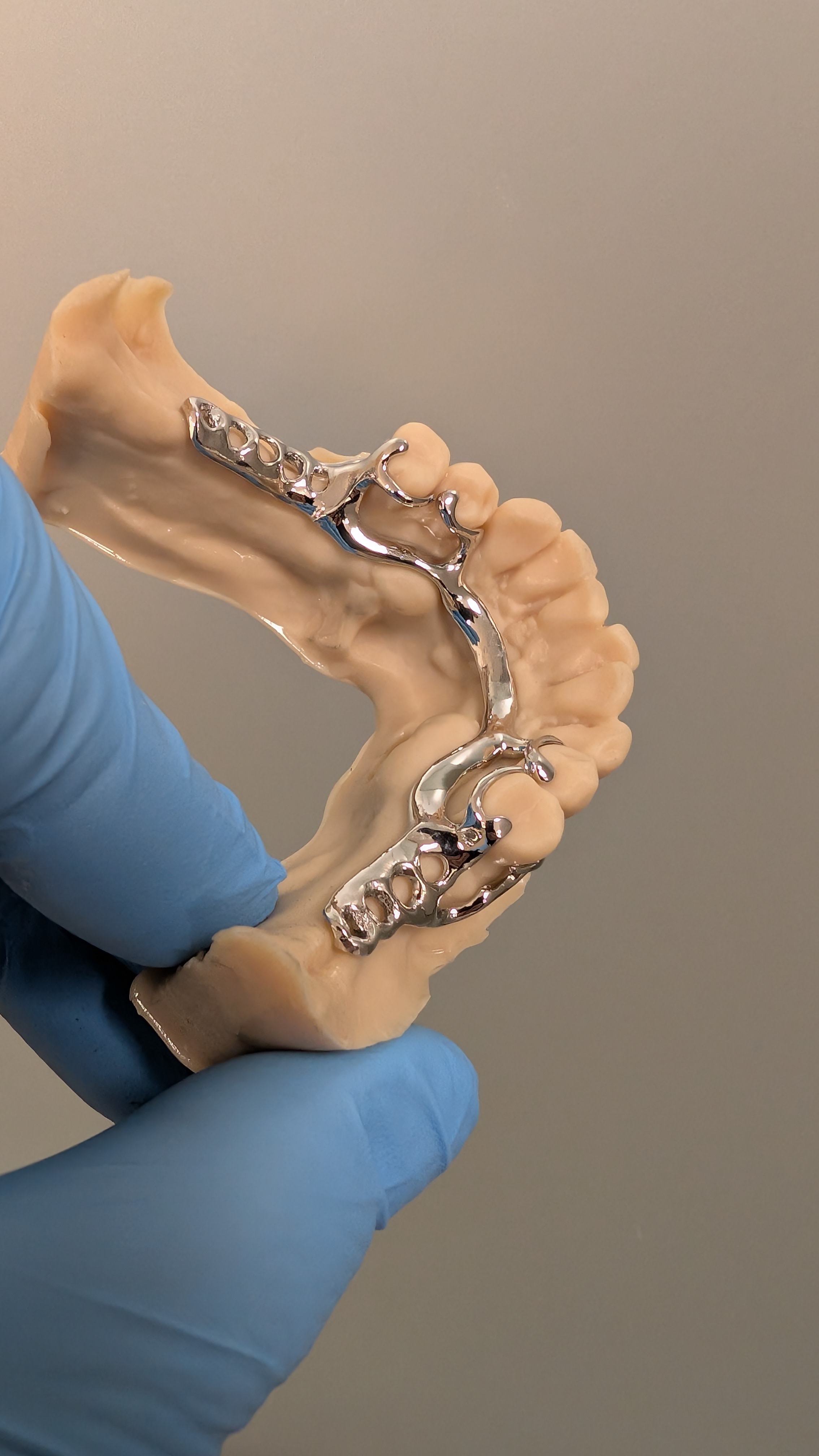 Lower partial framework on dental model - underside