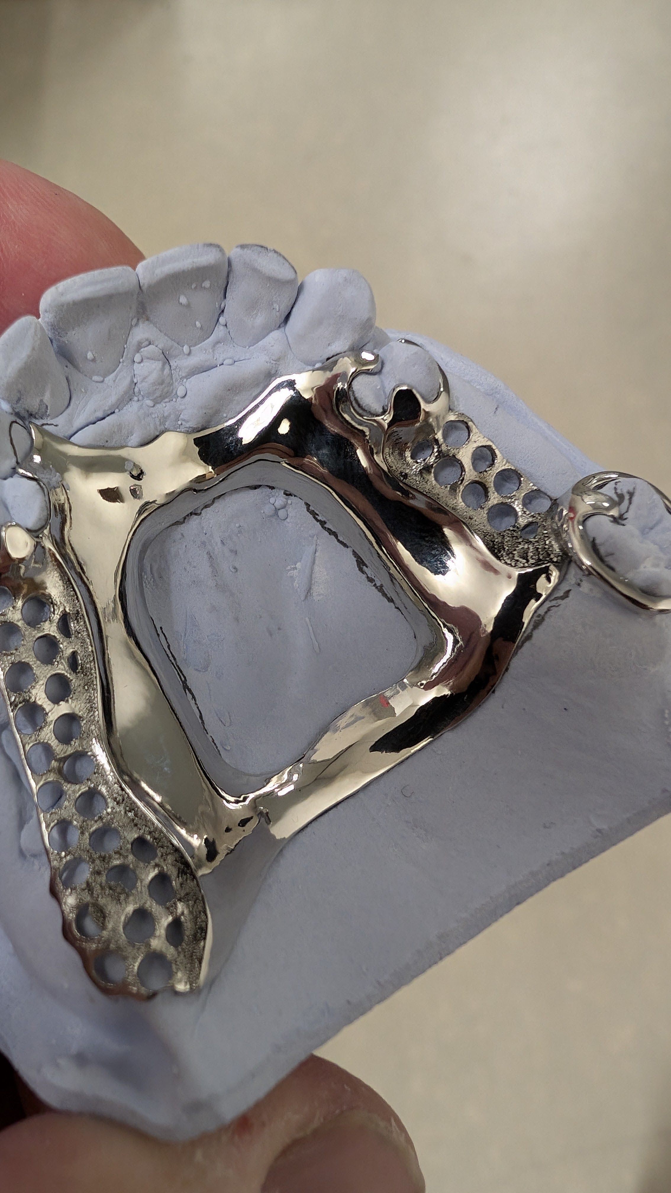 Upper partial framework with mesh retention