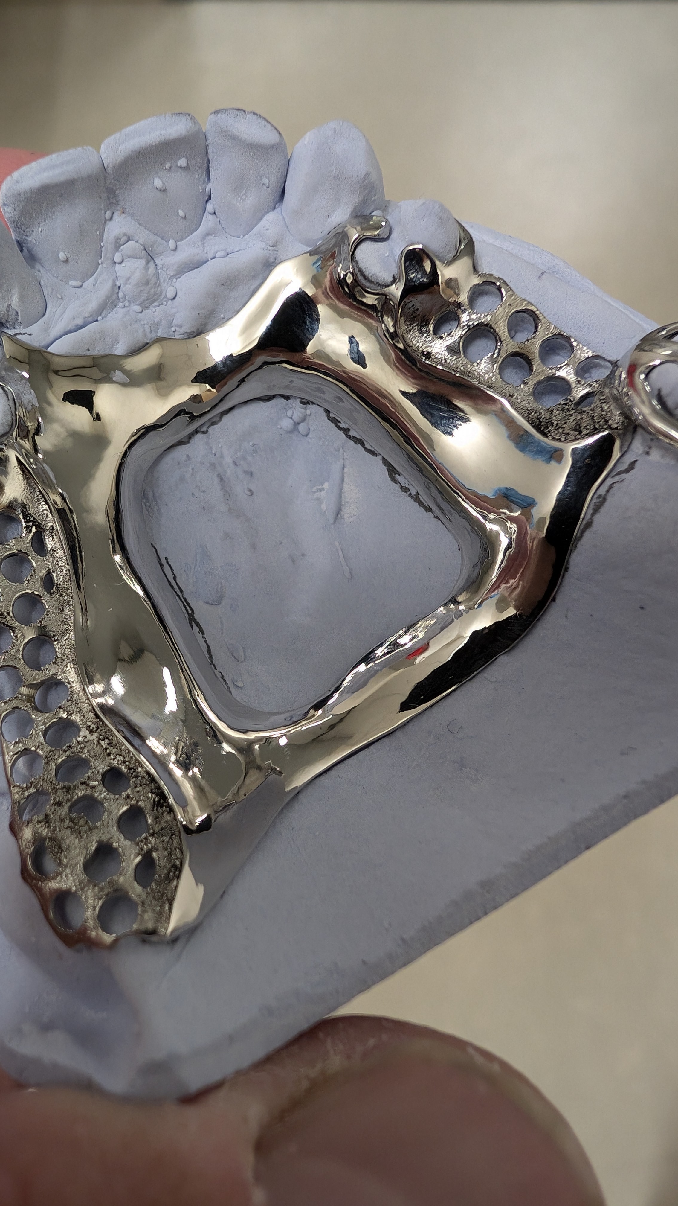 Upper partial framework detail view